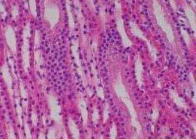 Hematoxylin & Eosin Stain: Primate Organs Tissue MicroArray (Normal) [NBP2-30188] -  39. Kidney, medulla