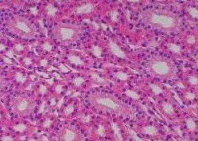 Hematoxylin & Eosin Stain: Primate Organs Tissue MicroArray (Normal) [NBP2-30188] -  40. Kidney, medulla