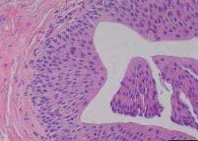 Hematoxylin & Eosin Stain: Primate Organs Tissue MicroArray (Normal) [NBP2-30188] - 41. Ureter