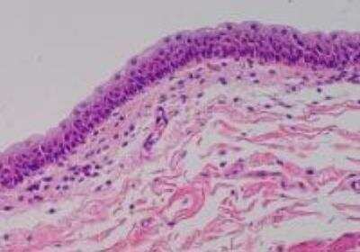 Hematoxylin & Eosin Stain: Primate Organs Tissue MicroArray (Normal) [NBP2-30188] -  43. Urinary bladder