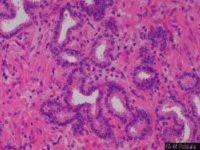 Hematoxylin & Eosin Stain: Primate Organs Tissue MicroArray (Normal) [NBP2-30188] -  44. Prostate