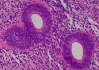 Hematoxylin & Eosin Stain: Primate Organs Tissue MicroArray (Normal) [NBP2-30188] - 49.Uterus, endometrium