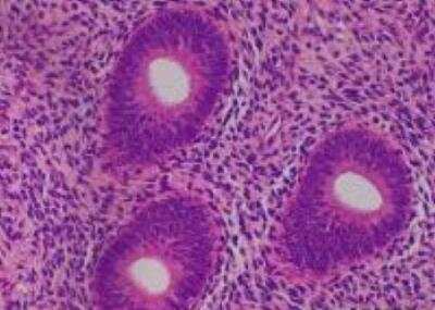 Hematoxylin & Eosin Stain: Primate Organs Tissue MicroArray (Normal) [NBP2-30188] -  50.Uterus, endometrium