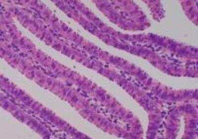 Hematoxylin & Eosin Stain: Primate Organs Tissue MicroArray (Normal) [NBP2-30188] - 51.Salpinx