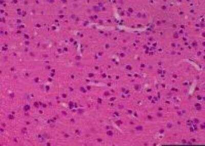 Hematoxylin & Eosin Stain: Primate Organs Tissue MicroArray (Normal) [NBP2-30188] -  53.Frontal lobe