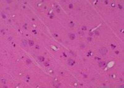 Hematoxylin & Eosin Stain: Primate Organs Tissue MicroArray (Normal) [NBP2-30188] - 54.Parietal lobe