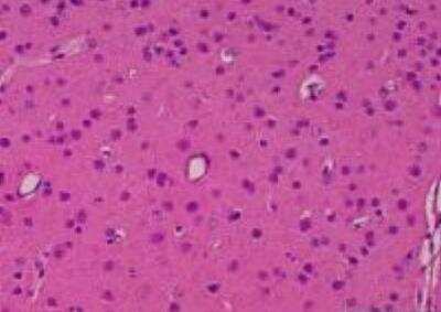 Hematoxylin & Eosin Stain: Primate Organs Tissue MicroArray (Normal) [NBP2-30188] - 55.Occipital lobe