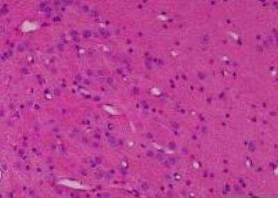 Hematoxylin & Eosin Stain: Primate Organs Tissue MicroArray (Normal) [NBP2-30188] -  56. Brain stem