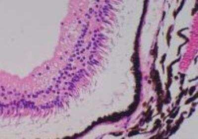 Hematoxylin & Eosin Stain: Primate Organs Tissue MicroArray (Normal) [NBP2-30188] -  60. Eyeball