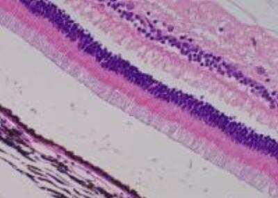 Hematoxylin & Eosin Stain: Primate Organs Tissue MicroArray (Normal) [NBP2-30188] -  59. Eyeball