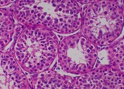 Hematoxylin & Eosin Stain: Primate Organs Tissue MicroArray (Normal) [NBP2-30188] -  46. Testis