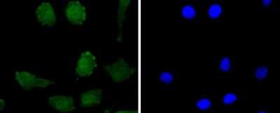 Immunocytochemistry/Immunofluorescence: PrPC Antibody (SC57-05) [NBP2-67569] - Staining PrPC in SH-SY-5Y cells (green). The nuclear counter stain is DAPI (blue). Cells were fixed in paraformaldehyde, permeabilised with 0.25% Triton X100/PBS.