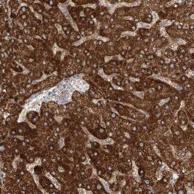 Immunohistochemistry ProSAPiP1 Antibody - BSA Free