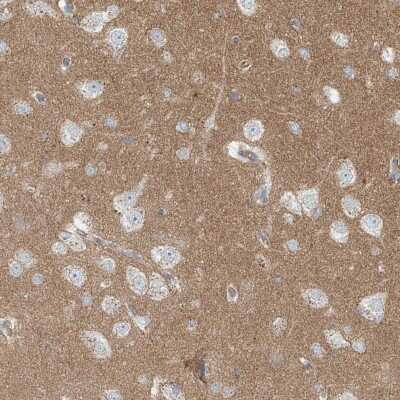 Immunohistochemistry-Paraffin: ProSAPiP1 Antibody [NBP1-91018] - Staining of human cerebral cortex shows strong positivity in neuropil.