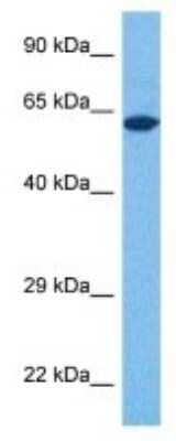 Western Blot: ProSAPiP1 Antibody [NBP3-09992] - Western blot analysis of ProSAPiP1 in Human 293T Whole Cell. Antibody dilution at 1.0ug/ml