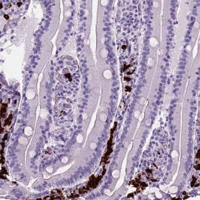 Immunohistochemistry-Paraffin: Proapoptotic Caspase Adaptor Protein Antibody [NBP2-55874] - Staining of human small intestine shows strong cytoplasmic positivity in lymphoid cells.