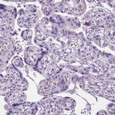 Immunohistochemistry-Paraffin: Proapoptotic Caspase Adaptor Protein Antibody [NBP2-55874] - Staining of human placenta shows no positivity in trophoblastic cells as expected.