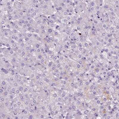 <b>Independent Antibodies Validation. </b>Immunohistochemistry-Paraffin: Proapoptotic Caspase Adaptor Protein Antibody [NBP2-55874] - Staining of human liver shows no positivity in hepatocytes as expected.