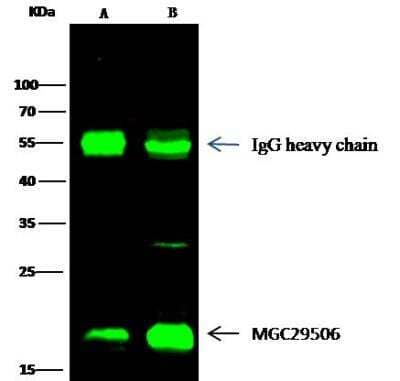 Immunoprecipitation: Proapoptotic Caspase Adaptor Protein Antibody [NBP2-97099] - Lane A:0.5 mg Raji Whole Cell LysateLane B:0.5 mg Daudi Whole Cell Lysate2 uL anti-MGC29506 rabbit polyclonal antibody and 15 ul of 50 % Protein G agarose.Primary antibody:Anti-MGC29506 rabbit polyclonal antibody,at 1:200 dilution Secondary antibody:Dylight 800-labeled antibody to rabbit IgG (H+L), at 1:5000 dilution Developed using the odssey technique.Performed under reducing conditions.Predicted band size: 20 kDaObserved band size: 20 kDa