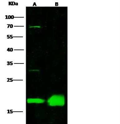 Western Blot: Proapoptotic Caspase Adaptor Protein Antibody [NBP2-97099] - Lane A: Molt4 Whole Cell Lysate. Lane B: Raji Whole Cell Lysate. Lysates/proteins at 30 ug per lane. Secondary: Goat Anti-Rabbit IgG H&L (Dylight800) at 1/10000 dilution. Developed using the Odyssey technique.  Performed under reducing conditions. Predicted band size:21 kDa. Observed band size:18 kDa. (We are unsure as to the identity of these extra bands.)