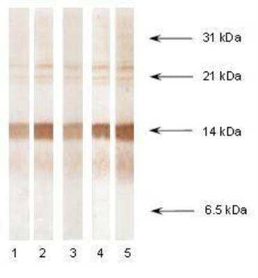 Western Blot: Procalcitonin Antibody (27A3) [NB110-13042] - Immunodetection of human recombinant Procalcitonin in Western blotting by different monoclonal antibodies specific to N-terminal part of Procalcitonin after SDS-PAGE in reducing conditions.