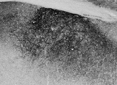 Immunohistochemistry-Frozen: Proenkephalin Antibody [NBP1-20963] - Staining of PFA-perfused cryosection of Mouse Stria terminalis.  HRP-staining with Ni-DAB after Biotin-SP-anti-goat amplification. Data obtained by Prof. Erik Hrabovszky, Inst, Exp, Med., Budapest, Hungary.