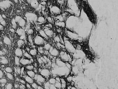 Immunohistochemistry-Frozen: Proenkephalin Antibody [NBP1-20963] - Staining of PFA-perfused cryosection of Rat Striatum.  HRP-staining with Ni-DAB after Biotin-SP-anti-goat amplification. Data obtained by Prof. Erik Hrabovszky, Inst, Exp, Med., Budapest, Hungary.