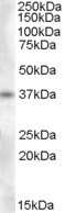 Western Blot: Proenkephalin Antibody [NBP1-06066] - (0.3ug/ml) staining of Human Adrenal Gland lysate (35ug protein in RIPA buffer). Primary incubation was 1 hour. Detected by chemiluminescence.