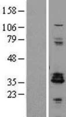 Western Blot: Proenkephalin Overexpression Lysate (Adult Normal) [NBP2-11091] Left-Empty vector transfected control cell lysate (HEK293 cell lysate); Right -Over-expression Lysate for Proenkephalin.