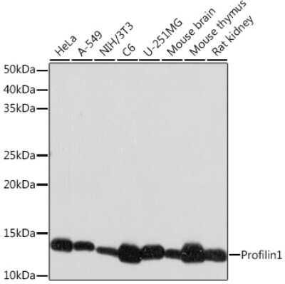 Western Blot: Profilin 1 Antibody (2Z1M4) [NBP3-16780] - Western blot analysis of extracts of various cell lines, using Profilin 1 Rabbit mAb (NBP3-16780) at 1:1000 dilution. Secondary antibody: HRP Goat Anti-Rabbit IgG (H+L) at 1:10000 dilution. Lysates/proteins: 25ug per lane. Blocking buffer: 3% nonfat dry milk in TBST. Detection: ECL Basic Kit. Exposure time: 30s.