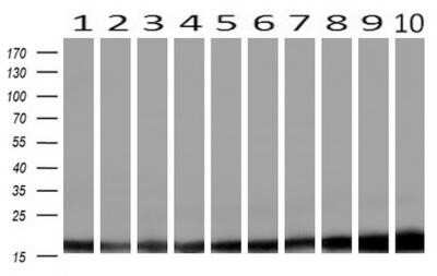 Western Blot: Profilin 1 Antibody (OTI1D5) - Azide and BSA Free [NBP2-73605] - Analysis of extracts (10ug) from 10 Human tissue by using anti-PFN1 monoclonal antibody at 1:200 (1: Testis; 2: Omentum; 3: Uterus; 4: Breast; 5: Brain; 6: Liver; 7: Ovary; 8: Thyroid gland; 9: colon;10: spleen).