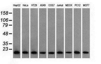 Western Blot: Profilin 1 Antibody (OTI1D5) - Azide and BSA Free [NBP2-73605] - Analysis of extracts (35ug) from 9 different cell lines by using anti-Profilin 1 monoclonal antibody.