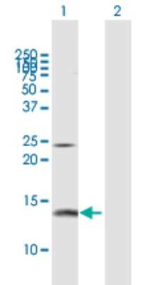 Western Blot: Profilin 2 Antibody [H00005217-D01P] - Analysis of PFN2 expression in transfected 293T cell line by PFN2 polyclonal antibody.Lane 1: PFN2 transfected lysate(15 KDa).Lane 2: Non-transfected lysate.