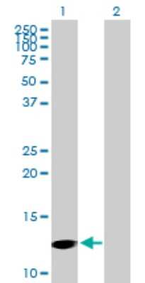 Western Blot Profilin 4 Antibody