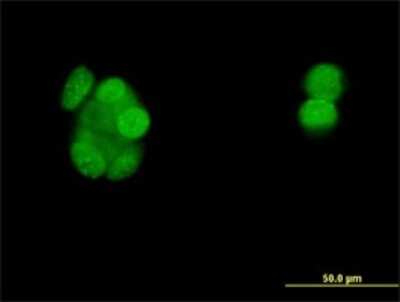 Immunocytochemistry/Immunofluorescence: Progesterone R/NR3C3 Antibody (3E11) [H00005241-M01] - Analysis of monoclonal antibody to PGR on MCF-7 cell . Antibody concentration 10 ug/ml.