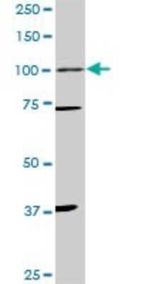Western Blot: Progesterone R/NR3C3 Antibody (3E11) [H00005241-M01] - PGR monoclonal antibody (M01), clone 3E11. Analysis of PGR expression in PC-12.