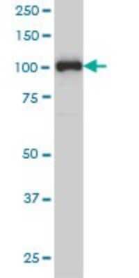 Western Blot: Progesterone R/NR3C3 Antibody (3E11) [H00005241-M01] - PGR monoclonal antibody (M01), clone 3E11 Analysis of PGR expression in MCF-7.