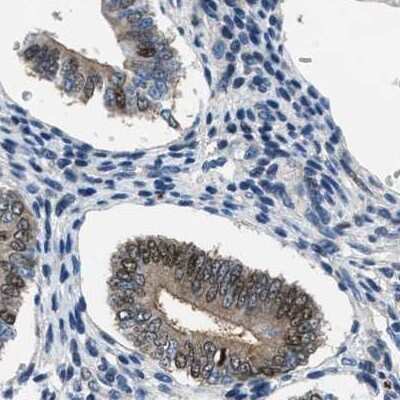 Immunohistochemistry-Paraffin: Progesterone R/NR3C3 Antibody [NBP1-87775] - Staining of human endometrium.