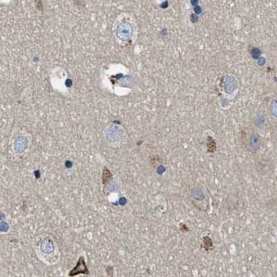 Immunohistochemistry-Paraffin: Progesterone R/NR3C3 Antibody [NBP1-87775] - Staining of human cerebral cortex.