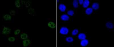 Immunocytochemistry/Immunofluorescence: Progesterone R/NR3C3 Antibody (JF0549) [NBP2-67079] - Staining Progesterone Receptor in MCF-7 cells (green). The nuclear counter stain is DAPI (blue). Cells were fixed in paraformaldehyde, permeabilised with 0.25% Triton X100/PBS.