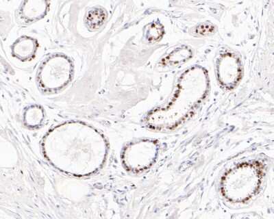 Immunohistochemistry-Paraffin: Progesterone R/NR3C3 Antibody (JF0549) [NBP2-67079] - Immunohistochemical analysis of paraffin-embedded human breast tissue using anti-Progesterone R/NR3C3 antibody. The section was pre-treated using heat mediated antigen retrieval with sodium citrate buffer (pH 6.0) for 20 minutes. The tissues were blocked in 5% BSA for 30 minutes at room temperature, washed with ddH2O and PBS, and then probed with the primary antibody (1/50) for 30 minutes at room temperature. The detection was performed using an HRP conjugated compact polymer system. DAB was used as the chromogen. Tissues were counterstained with hematoxylin and mounted with DPX.