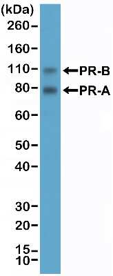 Western Blot: Progesterone R/NR3C3 Antibody (RM357) [NBP2-77437] - Western Blot of T47D cell lysate using NBP2-77437.