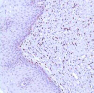 Immunohistochemistry-Paraffin: Progesterone R/NR3C3 Antibody (SP42) [NBP1-49806] - Human Cervix 