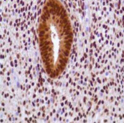 Immunohistochemistry-Paraffin: Progesterone R/NR3C3 Antibody (SP42) [NBP1-49806] - Human Endometrium
