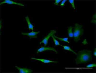 Immunocytochemistry/Immunofluorescence: Prohibitin Antibody (4B12-2G12) [H00005245-M02] - Analysis of monoclonal antibody to PHB on HeLa cell . Antibody concentration 15 ug/ml.