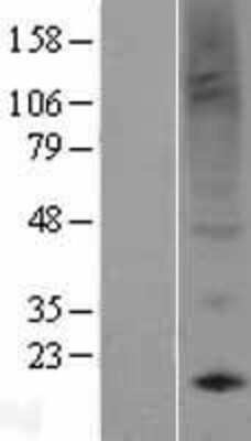 Western Blot EG-VEGF/PK1 Overexpression Lysate