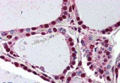 Immunohistochemistry-Paraffin: Prokineticin 2 Antibody [NBP1-44314] - Analysis of anti-PROKR2 antibody with human thyroid.