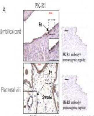 Immunohistochemistry: Prokineticin R1/PROKR1 Antibody [NBP2-15201] - Staining of human umbilical cord and placental villi