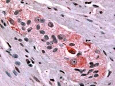 Immunohistochemistry-Paraffin: Prokineticin R1/PROKR1 Antibody [NLS3152] - IHC analysis of Colon using NLS3152 at 13 ug/ ml.