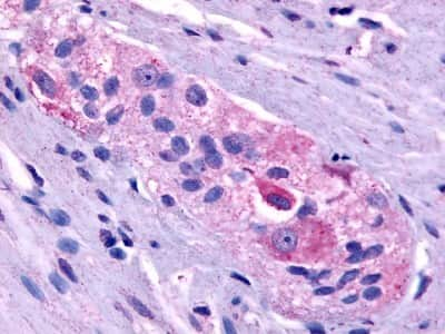 Immunohistochemistry-Paraffin: Prokineticin R1/PROKR1 Antibody [NLS3152] - Analysis of anti-PROKR1 antibody with human colon at 13 ug/ml.